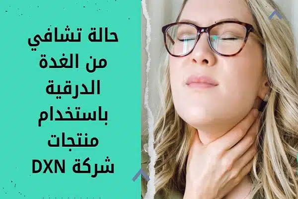 تجربة علاج خمول الغدة الدرقية بمنتجات dxn