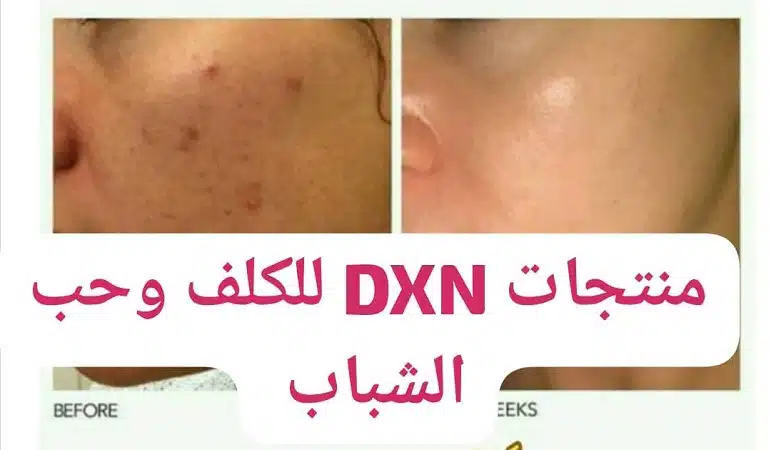 منتجات dxn لحب الشباب