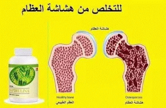 منتجات dxn لهشاشة العظام