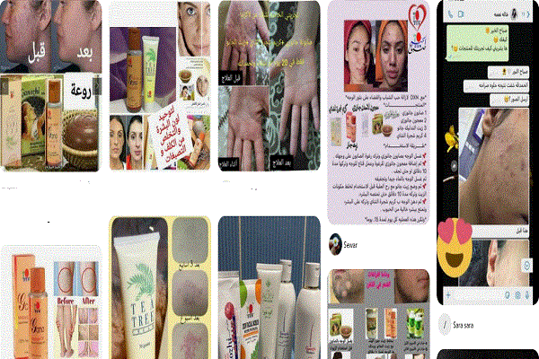 تجارب البنات مع منتجات dxn للبشره