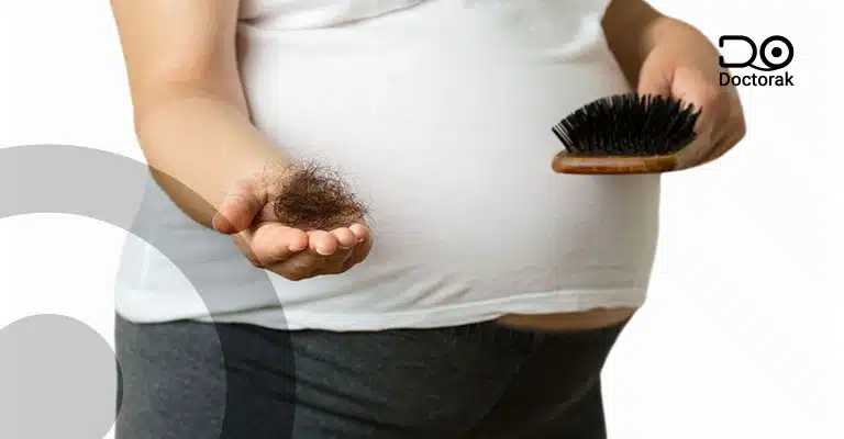 تساقط الشعر اثناء الحمل