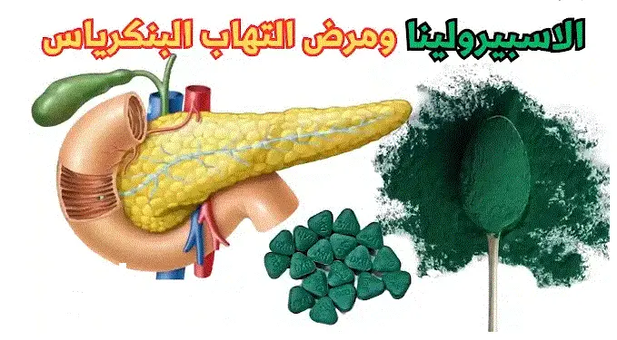 الاسبيرولينا والتهاب البنكرياس
