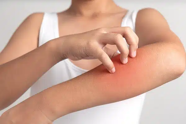 منتجات dxn للحساسية