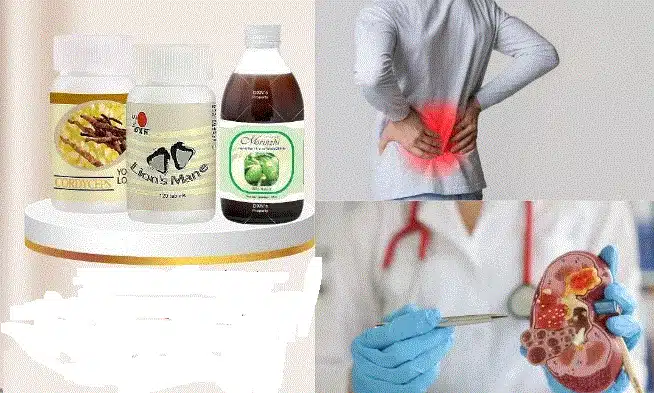 منتجات dxn لحصى الكلى 