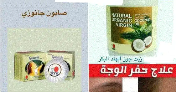 ازالة حفر الوجه طبيعيا