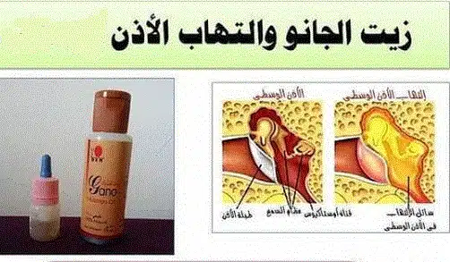 منتجات DXN لعلاج التهاب الأذن