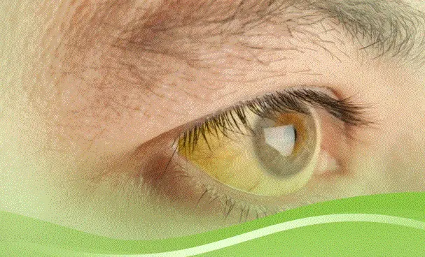 منتجات DXN لعلاج اليرقان
