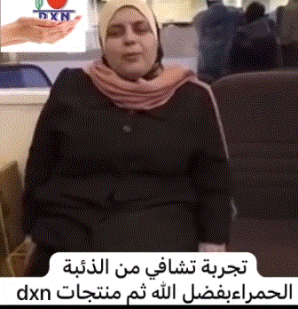 تجربتي مع الذئبة الحمراء