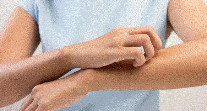 منتجات DXN للحكة