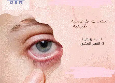 منتجات dxn للجلوكوما
