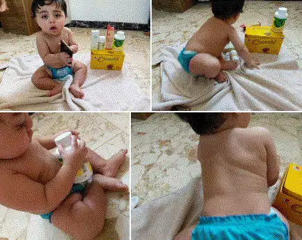 (معجزة الشفاء!) كيف تخلص طفل من الصدفية والبهاق بمنتجات دكسن! 2