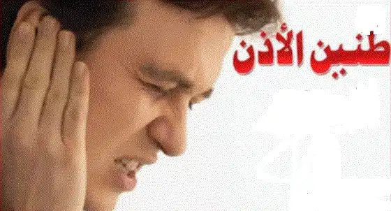 منتجات DXN لطنين الأذن