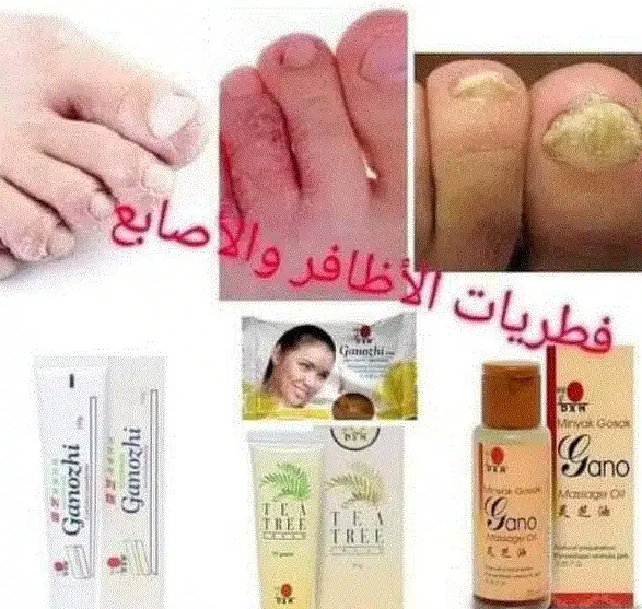منتجات dxn للفطريات