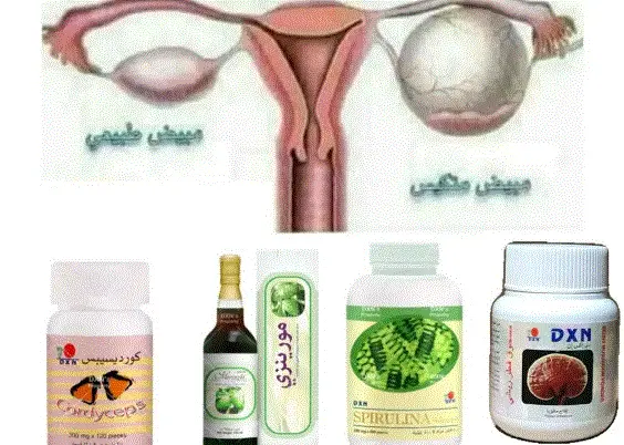 علاج تكيس المبايض dxn